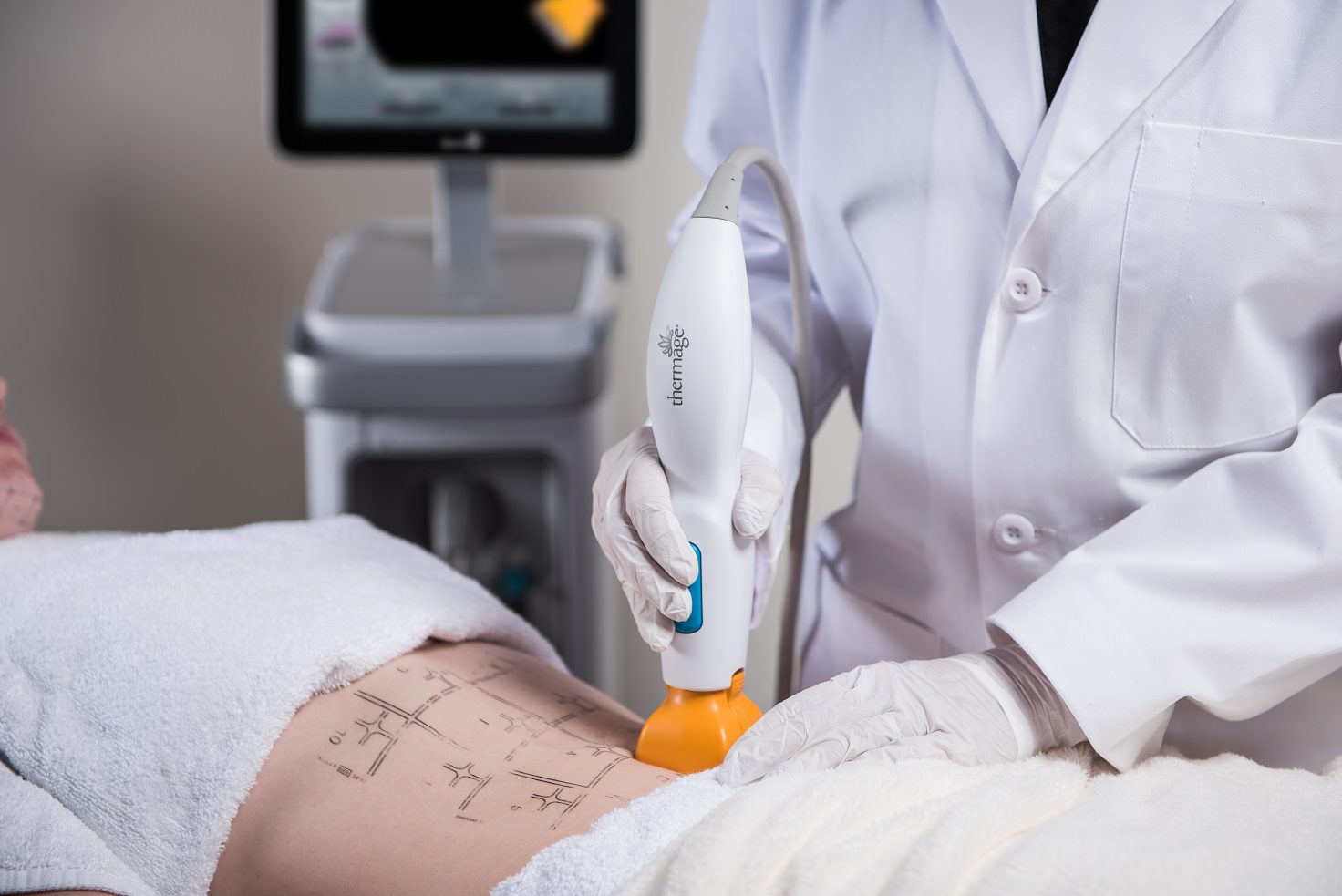 Thermage FLX Body