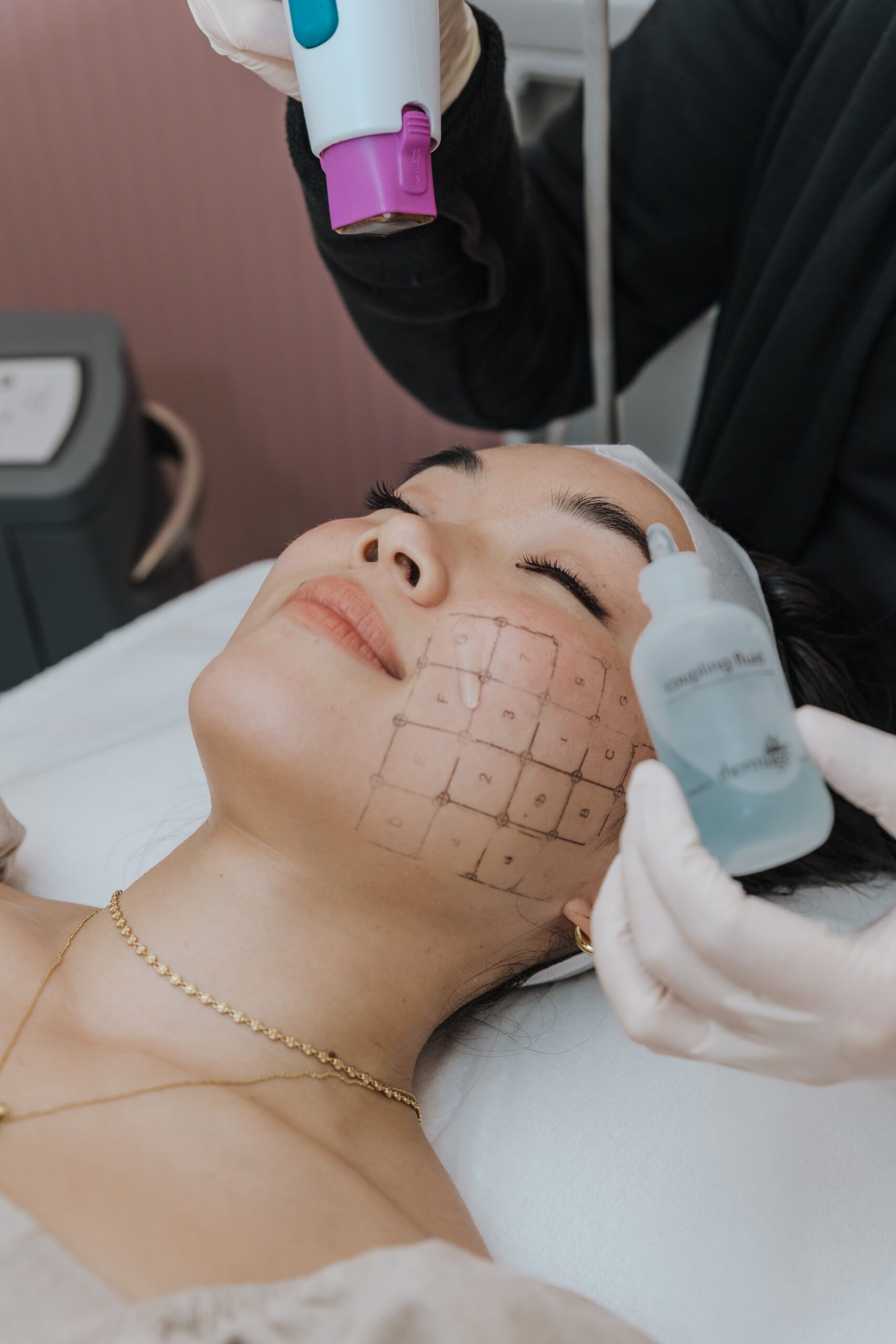 Patient on Thermage FLX