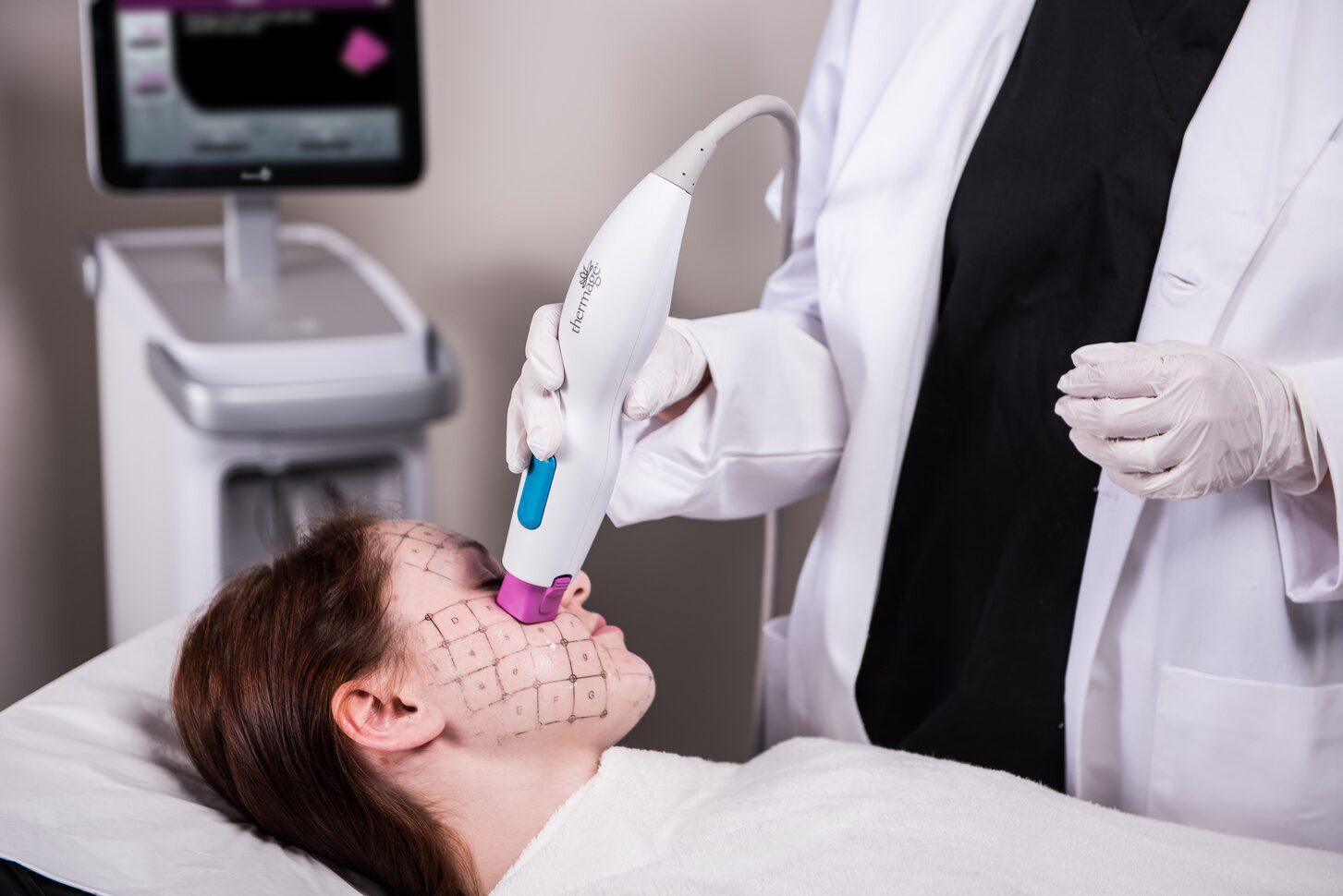 Thermage procedure for face