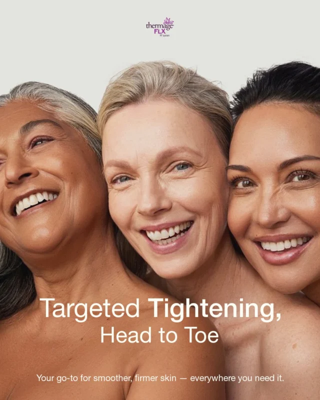 From eyes to thighs — and everywhere in between — Thermage delivers targeted tightening that works with your skin.
✨ Eyes: Smooth crow’s feet, refresh lids
✨ Face: Lift jawline, soften lines
✨ Neck: Firm and define contours
✨ Body: Tighten arms, tummy, knees, thighs
Wherever you need it, Thermage FLX brings precision, versatility, and proven results — all without surgery and with minimal to no downtime*.
📩 To learn more or find a qualified practitioner near you, visit the link in bio.
#Thermage
#ThermageFLX
#SkinTightening
#RFtechnology
#NonInvasive