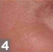 rejuvenate step 4