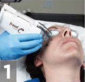scan-face step 1