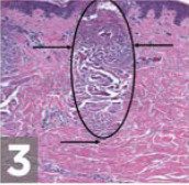 zoom-skin step 3