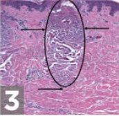 zoom-skin step 3