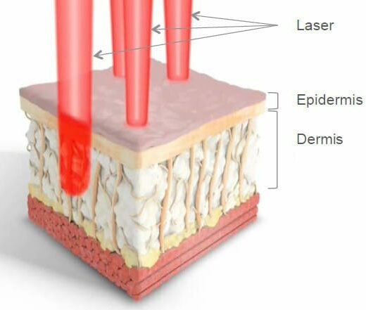dermis-v2